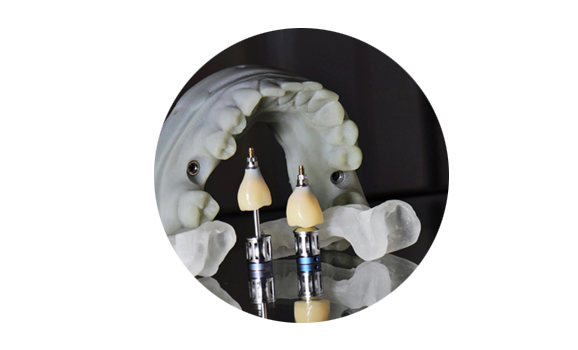 MODENA DENTAL LAB