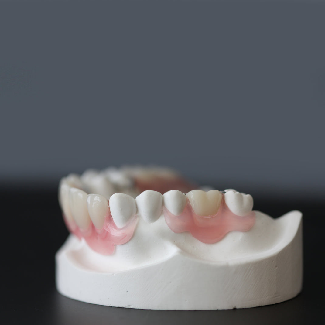Removable MODENA DENTAL LAB